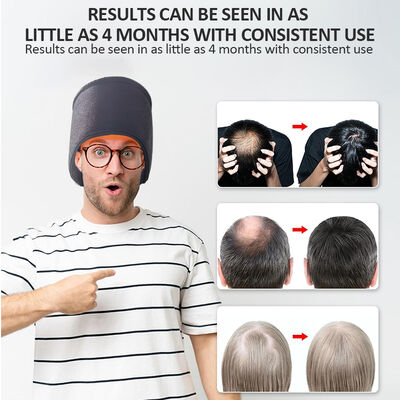 660nm Haarwachstums-Kappe LED Rotlichttherapie und 270 LED Rotlicht- und Lasertherapie-Kappe